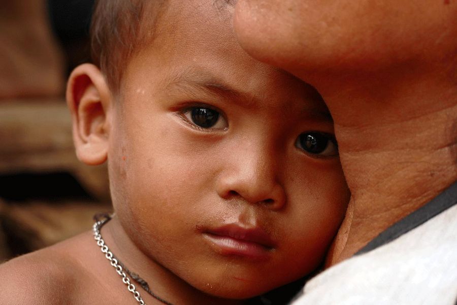 La malnutrition rend les enfants apathiques, nonchalants et fatigués