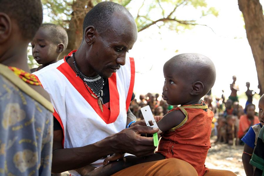 Au Kenya, un enfant a été soumis à un test de dépistage de la malnutrition